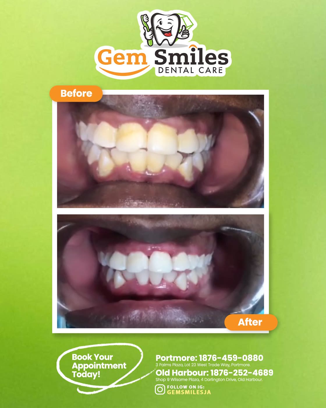 Gem Smiles social campaign & logo — artwork 4
